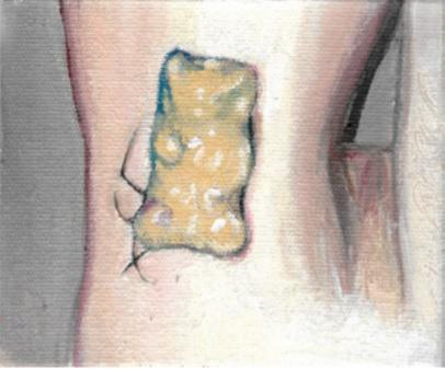 Untitled (Gummy)