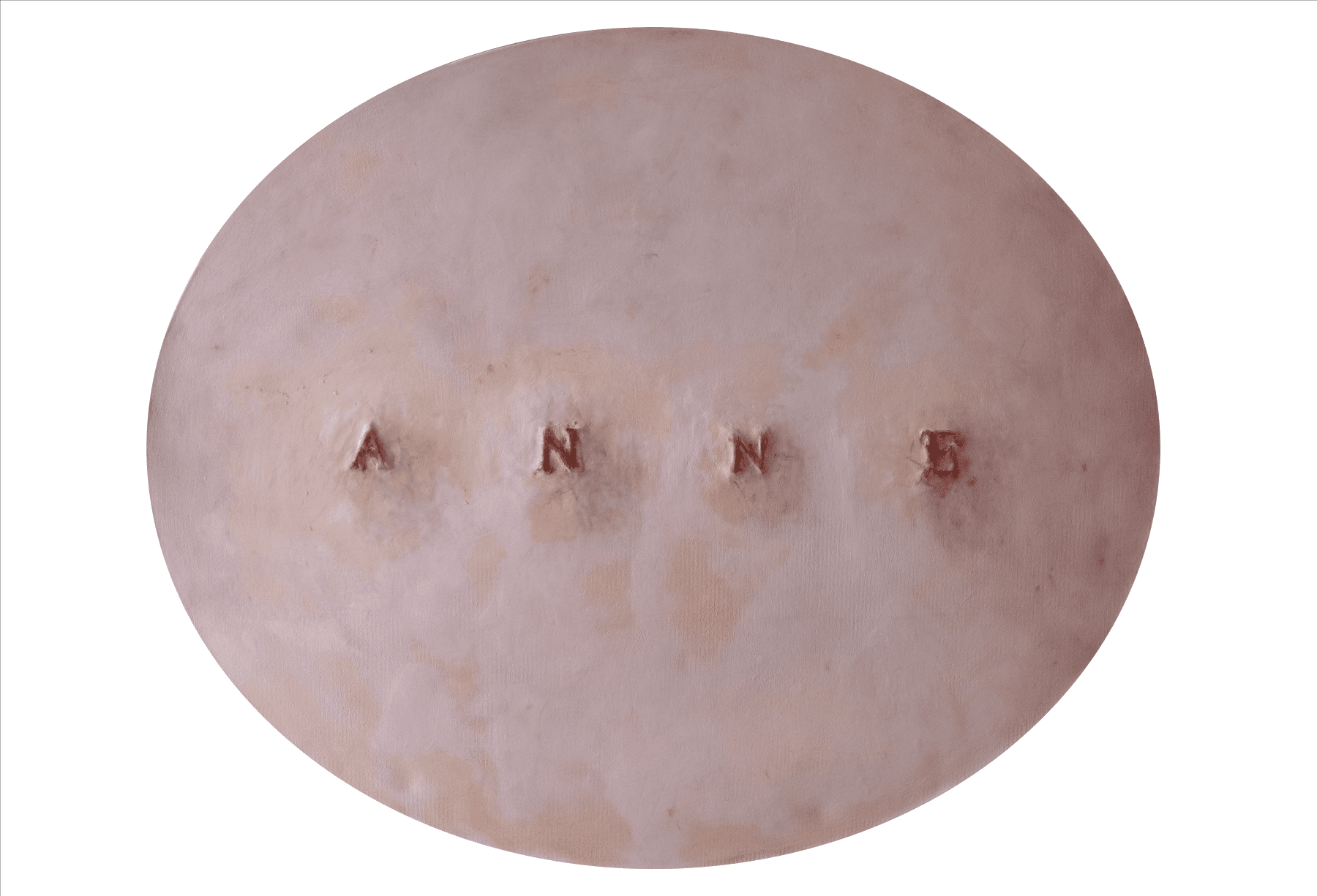Anne / Yara Serisi